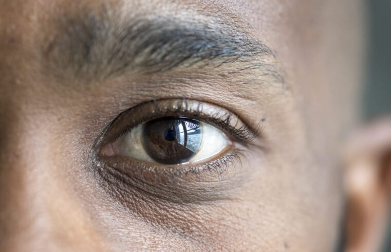 Problemas de visão se intensificam durante o verão alertam especialistas