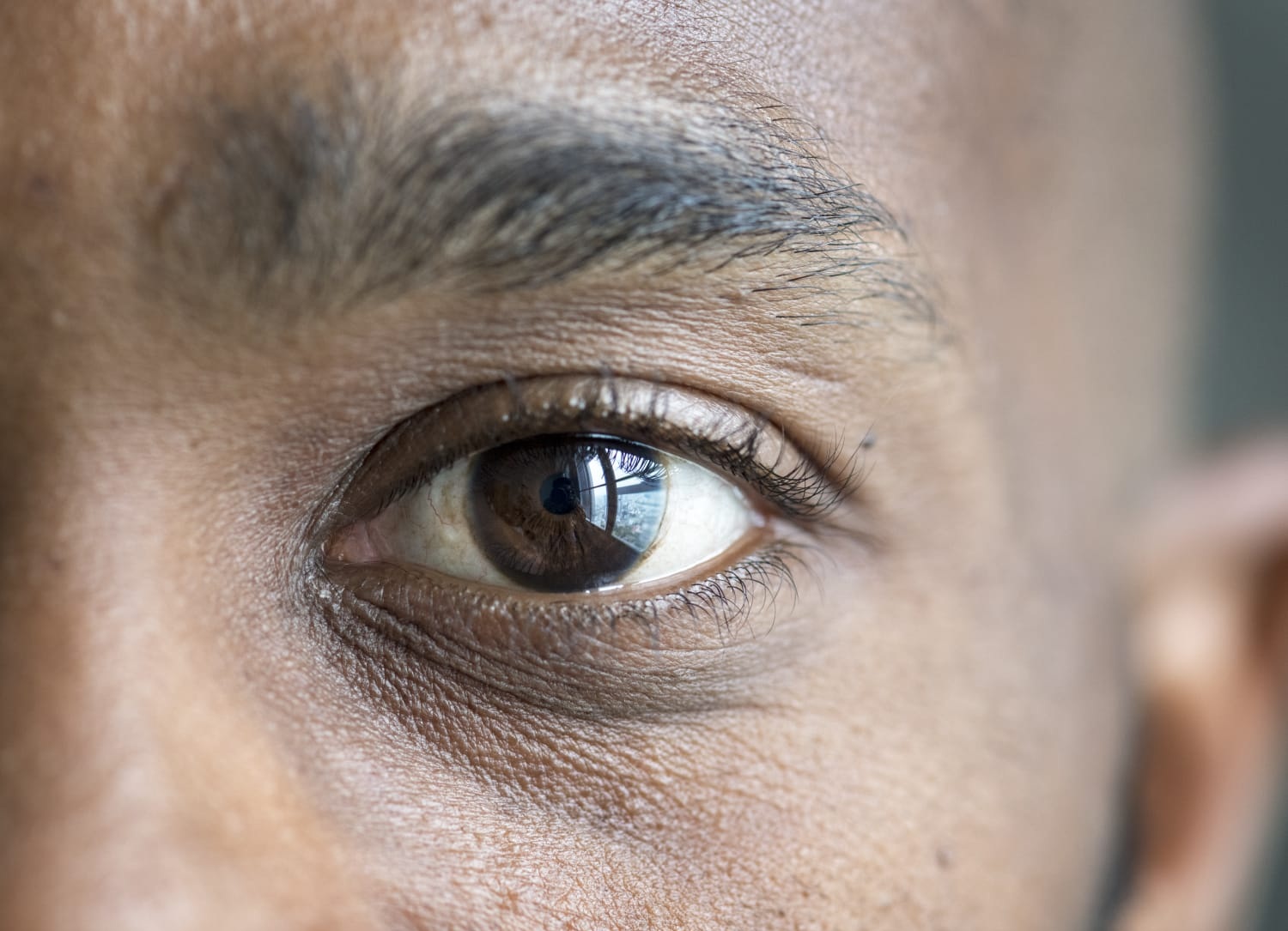 Problemas de visão se intensificam durante o verão alertam especialistas